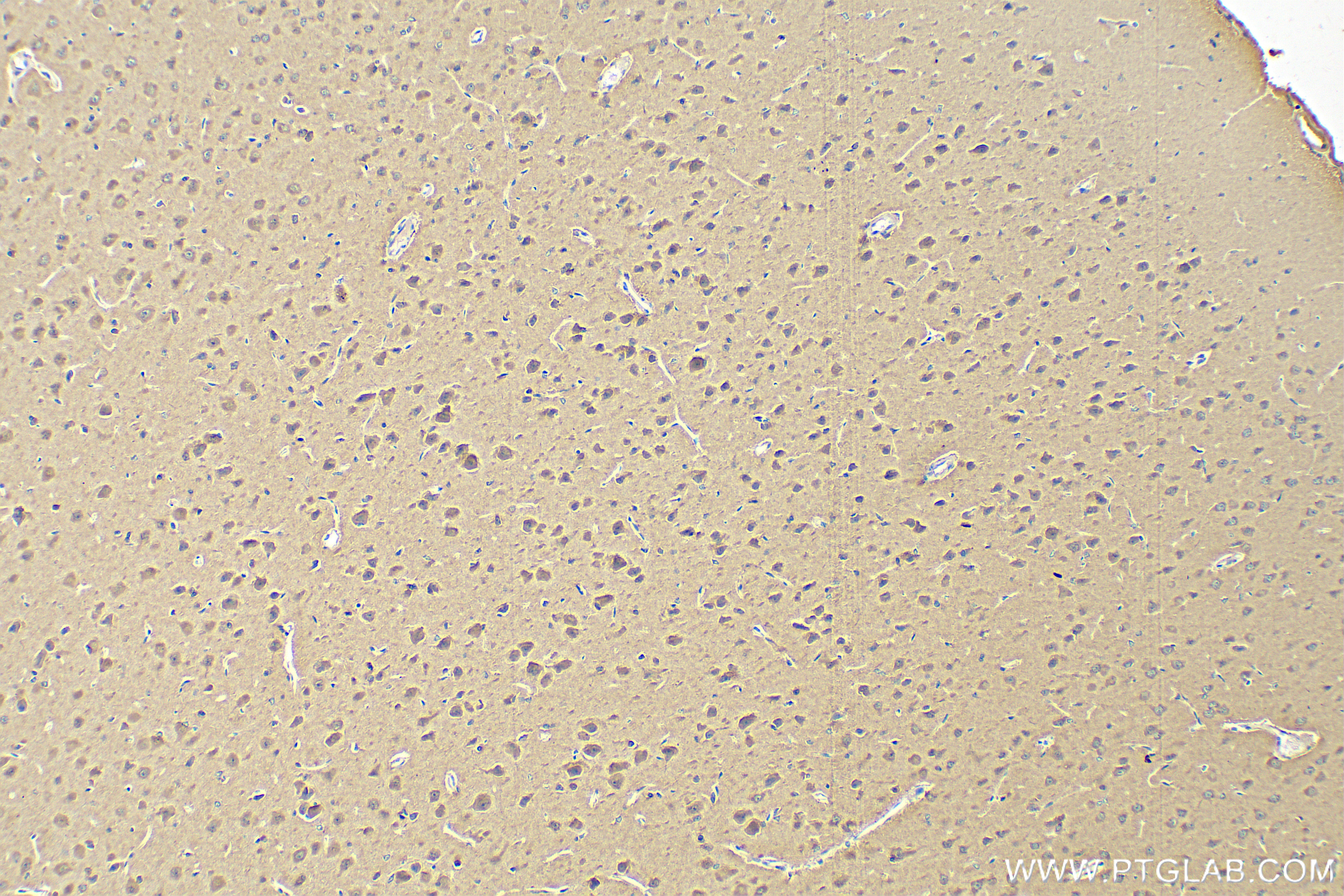 Immunohistochemistry (IHC) staining of rat brain tissue using Proenkephalin-A Polyclonal antibody (32272-1-AP)