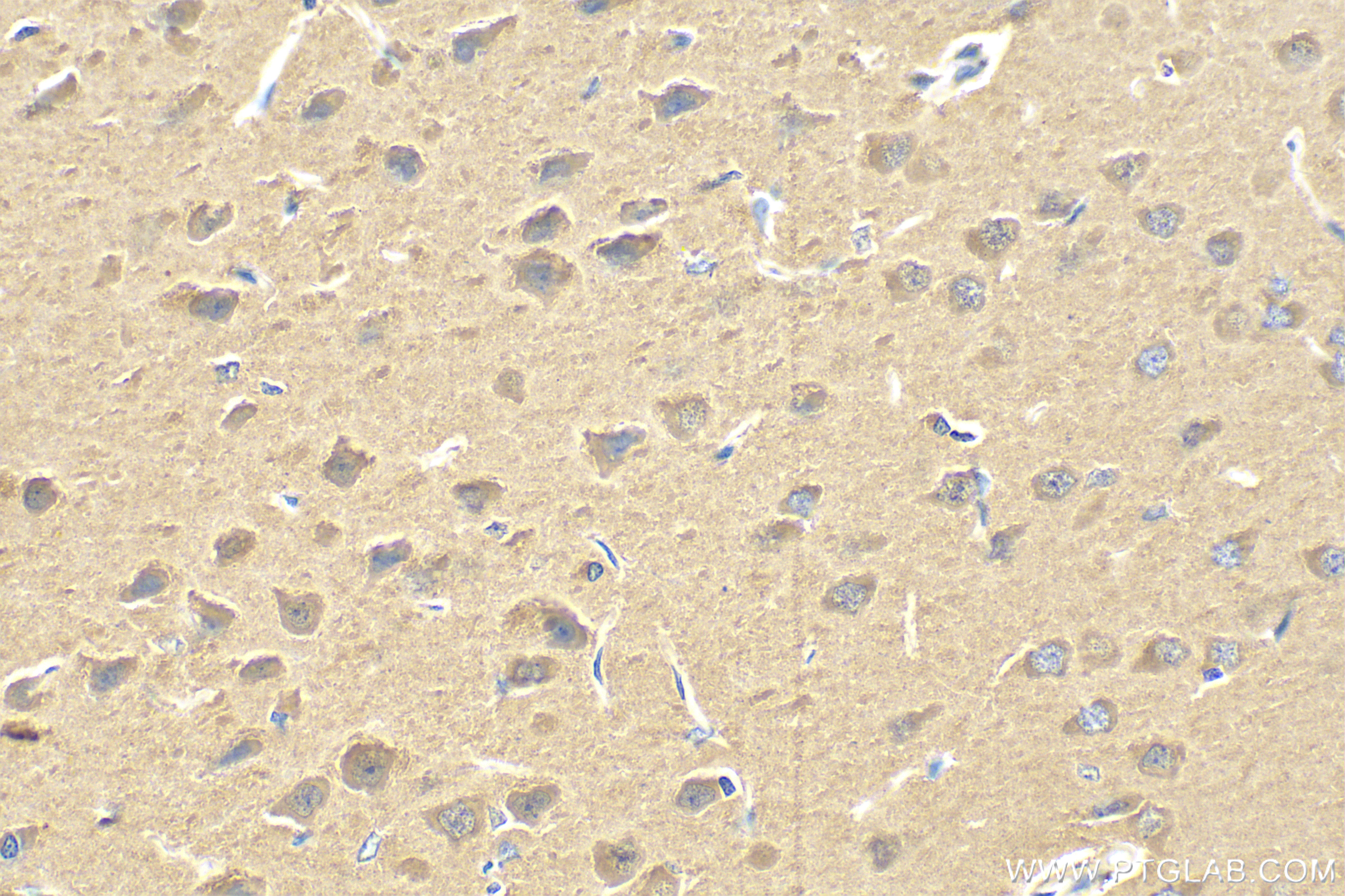Immunohistochemistry (IHC) staining of rat brain tissue using Proenkephalin-A Polyclonal antibody (32272-1-AP)