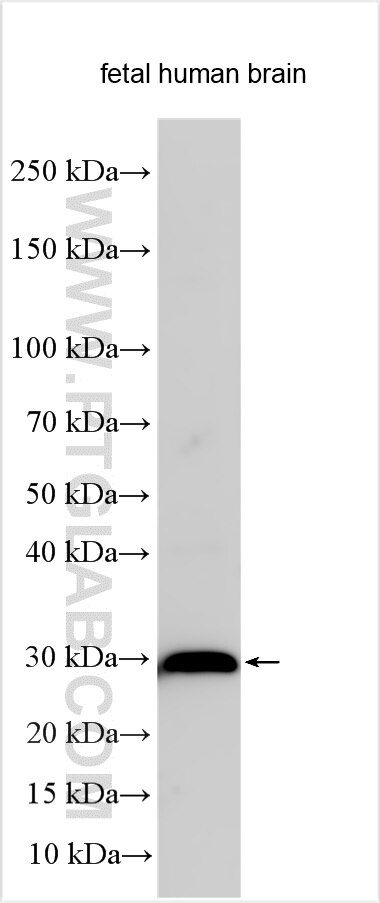 Western Blot (WB) analysis of various lysates using Proenkephalin-A Polyclonal antibody (32272-1-AP)