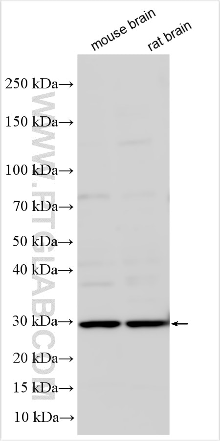 Western Blot (WB) analysis of various lysates using Proenkephalin-A Polyclonal antibody (32272-1-AP)