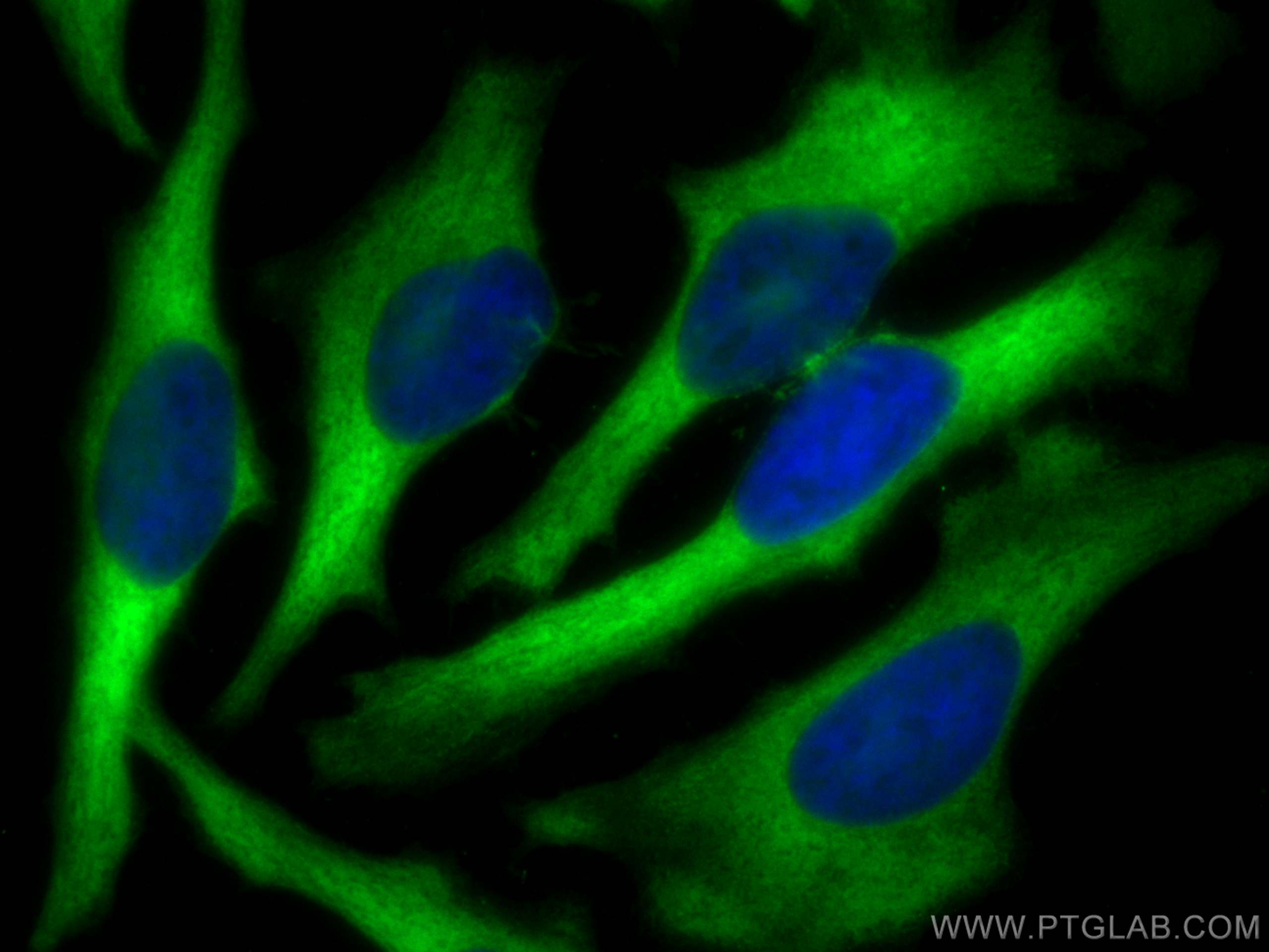 Immunofluorescence (IF) / fluorescent staining of HeLa cells using CoraLite® Plus 488-conjugated Profilin 1 Monoclona (CL488-67390)