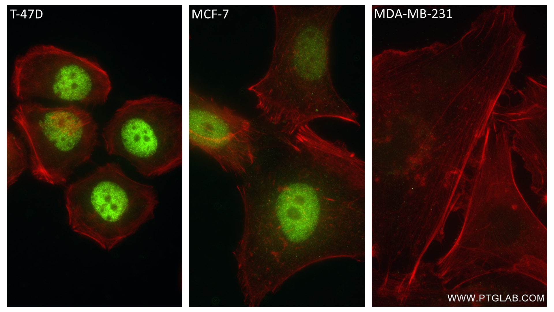 Immunofluorescence (IF) / fluorescent staining of T-47D cells using Progesterone Receptor Recombinant antibody (85112-4-RR)
