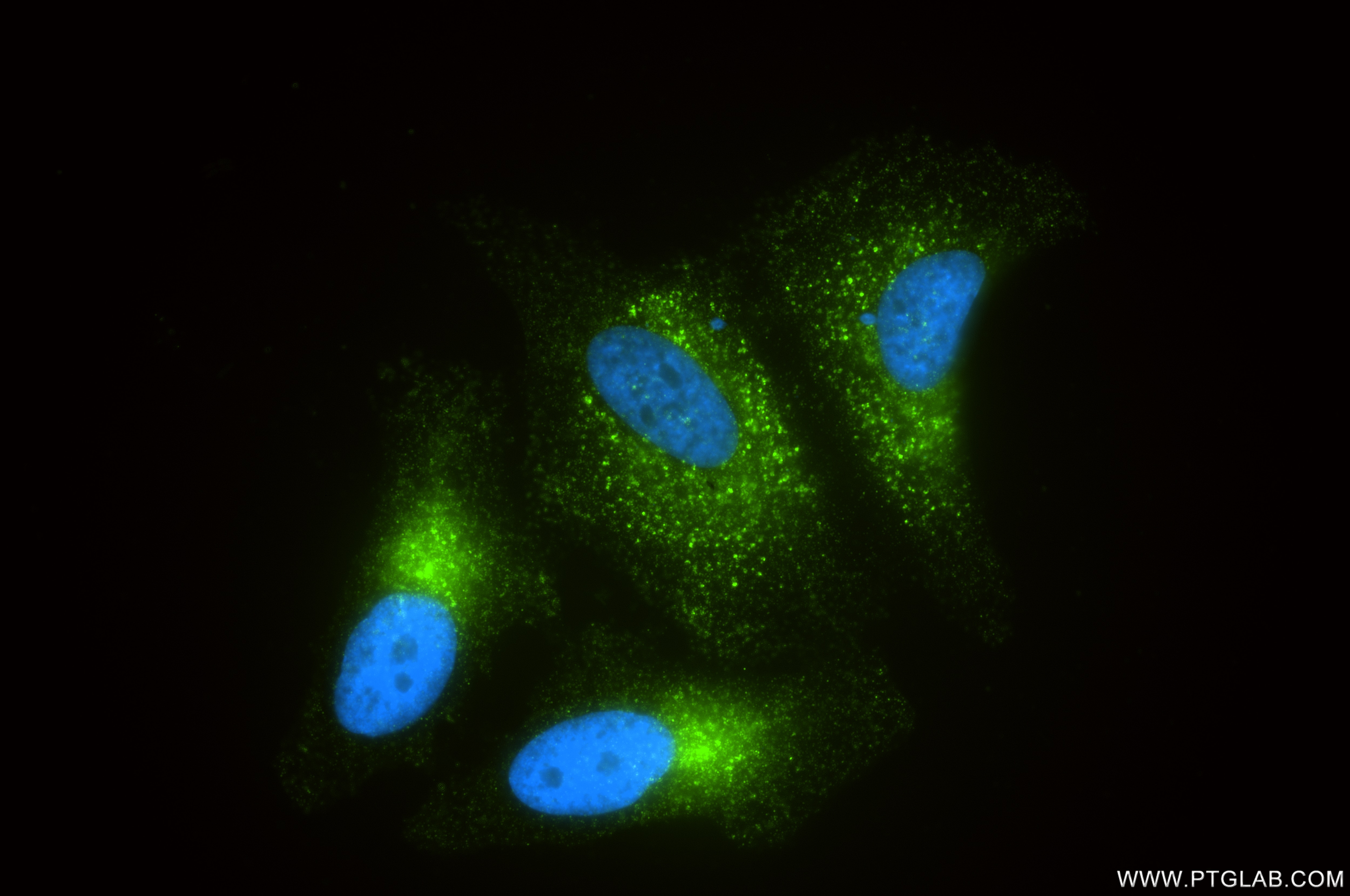 Immunofluorescence (IF) / fluorescent staining of HeLa cells using Progranulin/PGRN Recombinant monoclonal antibody (86118-2-RR)
