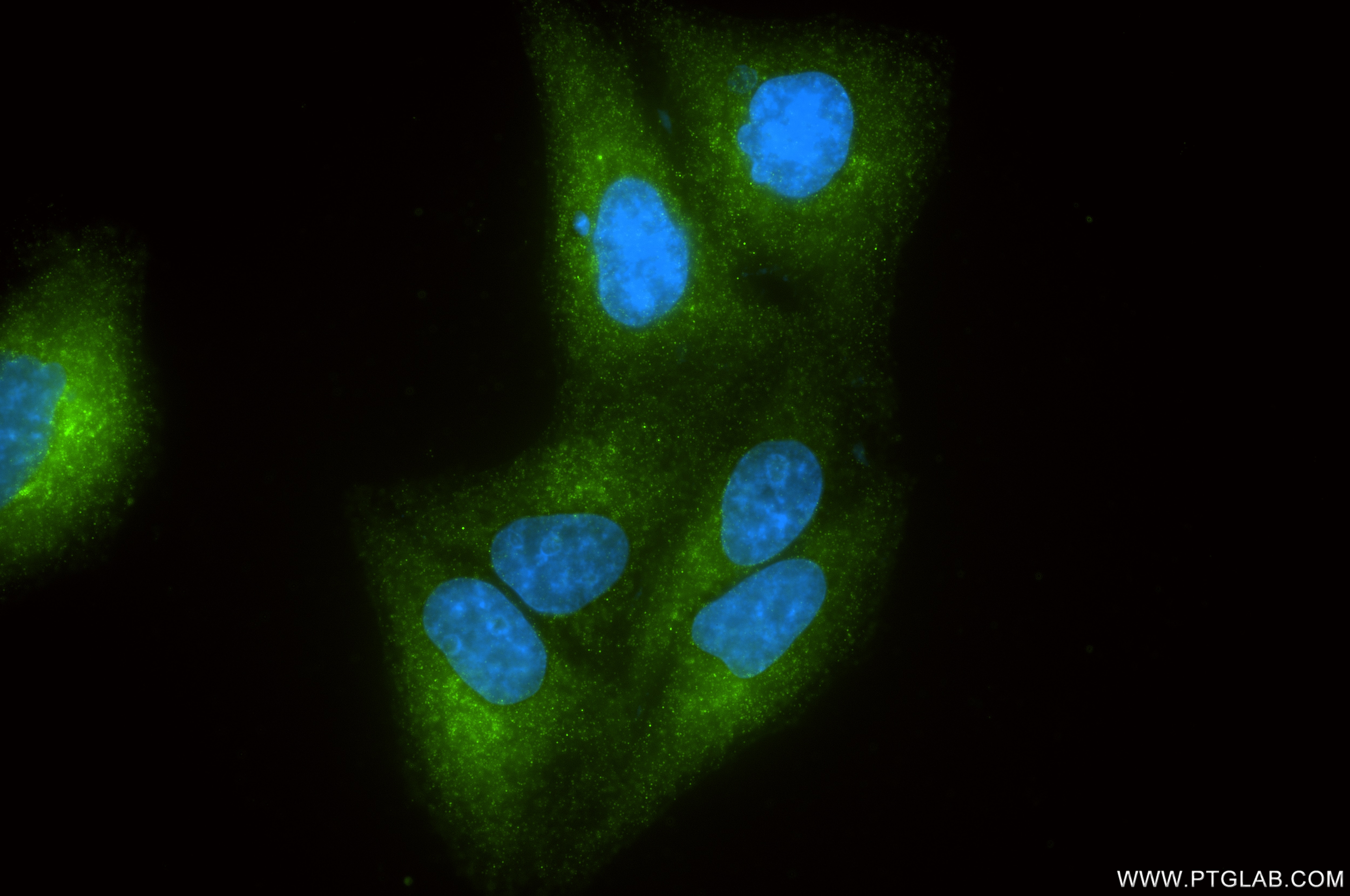 Immunofluorescence (IF) / fluorescent staining of HepG2 cells using Progranulin/PGRN Recombinant monoclonal antibody (86118-2-RR)
