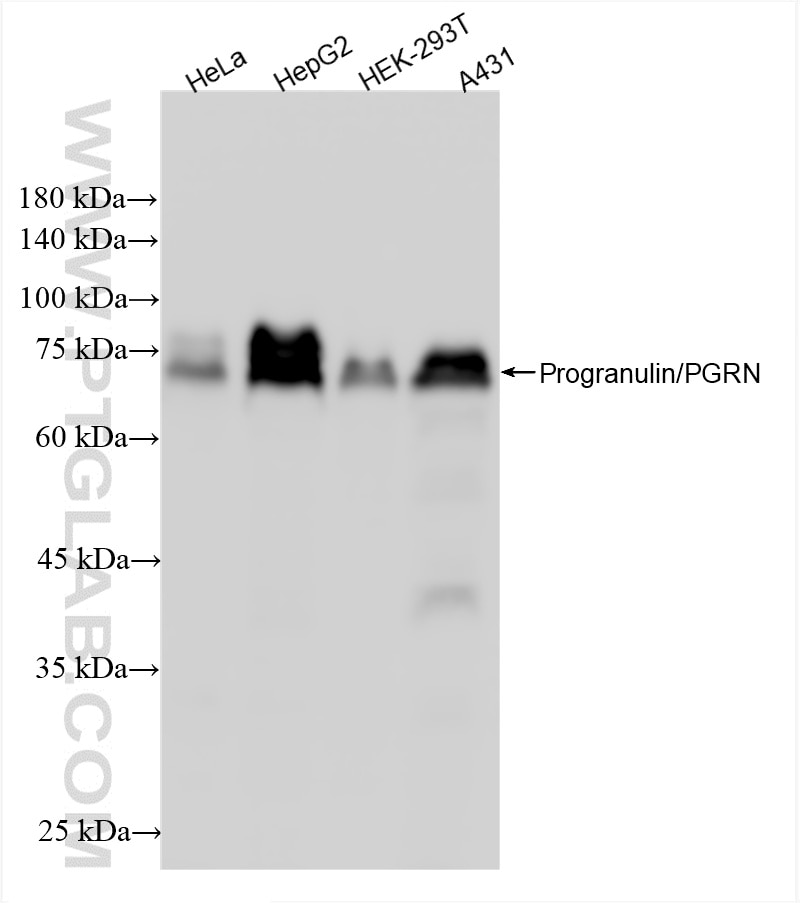 Progranulin/PGRN