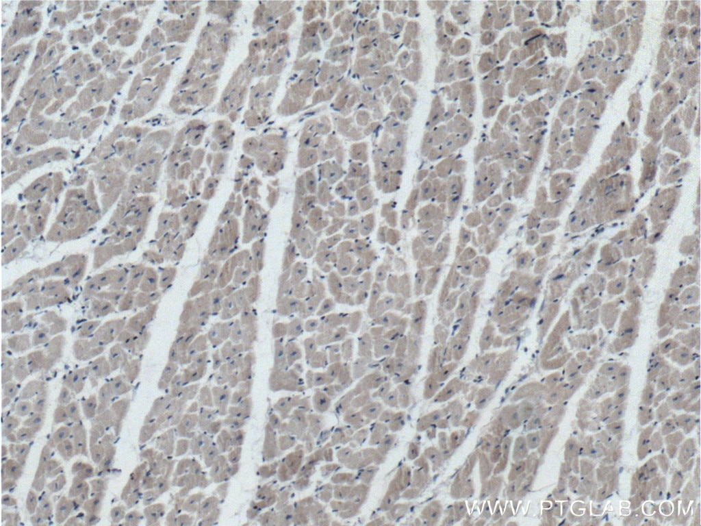 Immunohistochemistry (IHC) staining of human heart tissue using Prohibitin 2 Monoclonal antibody (66424-1-Ig)