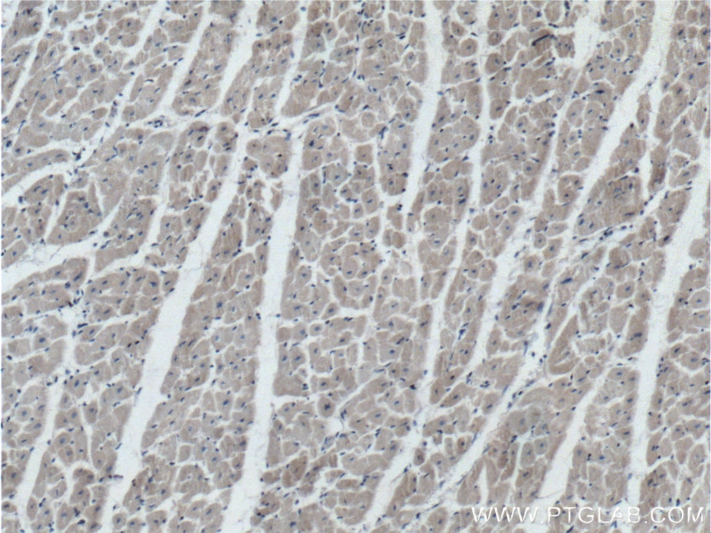 IHC staining of human heart using 66424-1-Ig