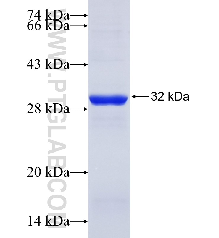 Prohibitin fusion protein Ag16664 SDS-PAGE