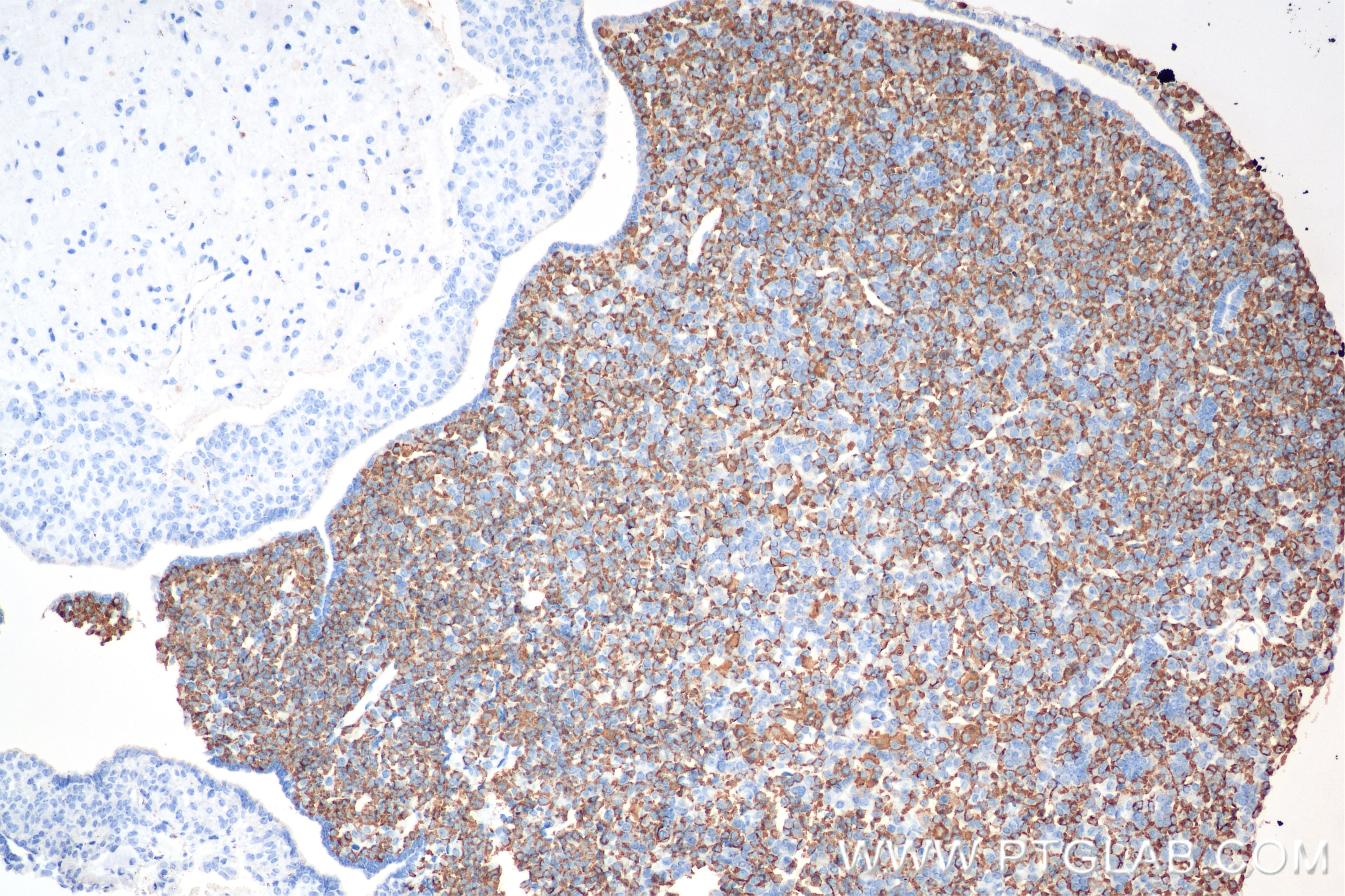 Immunohistochemistry (IHC) staining of mouse pituitary gland tissue using Prolactin Recombinant antibody (85042-1-RR)