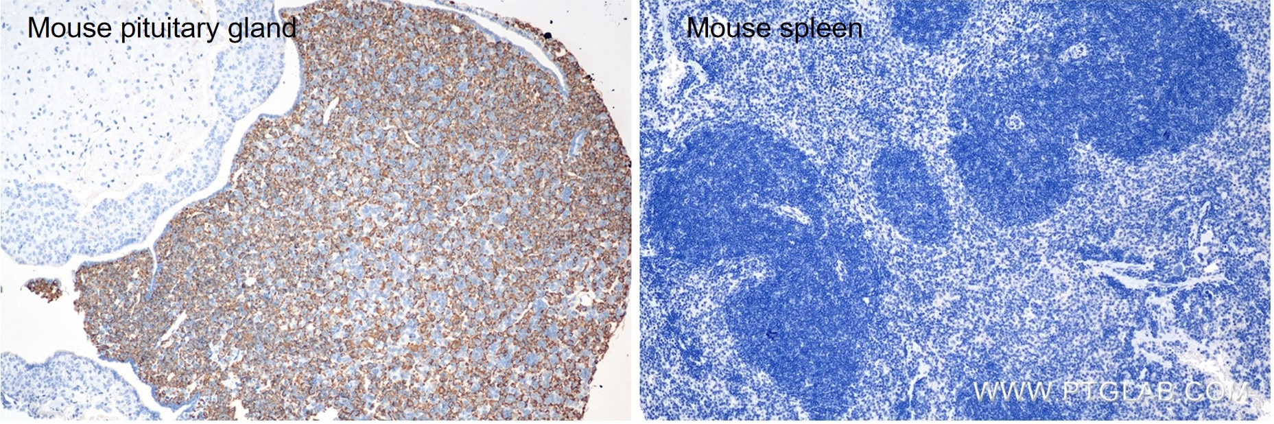 Immunohistochemistry (IHC) staining of mouse pituitary gland tissue using Prolactin Recombinant antibody (85042-1-RR)