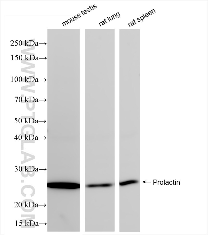 Western Blot (WB) analysis of various lysates using Prolactin Recombinant antibody (85042-1-RR)