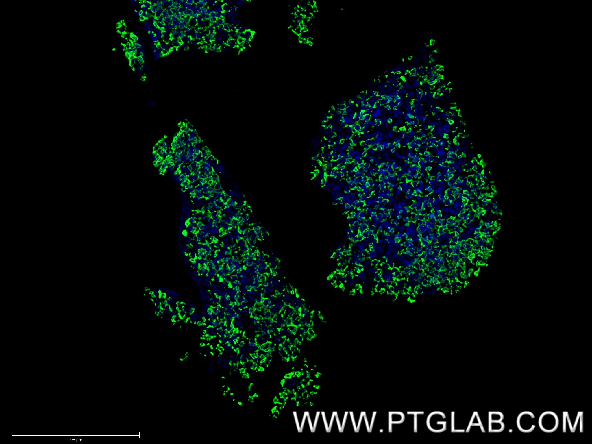 Immunofluorescence (IF) / fluorescent staining of mouse pituitary gland tissue using Prolactin Recombinant monoclonal antibody (85765-3-RR)