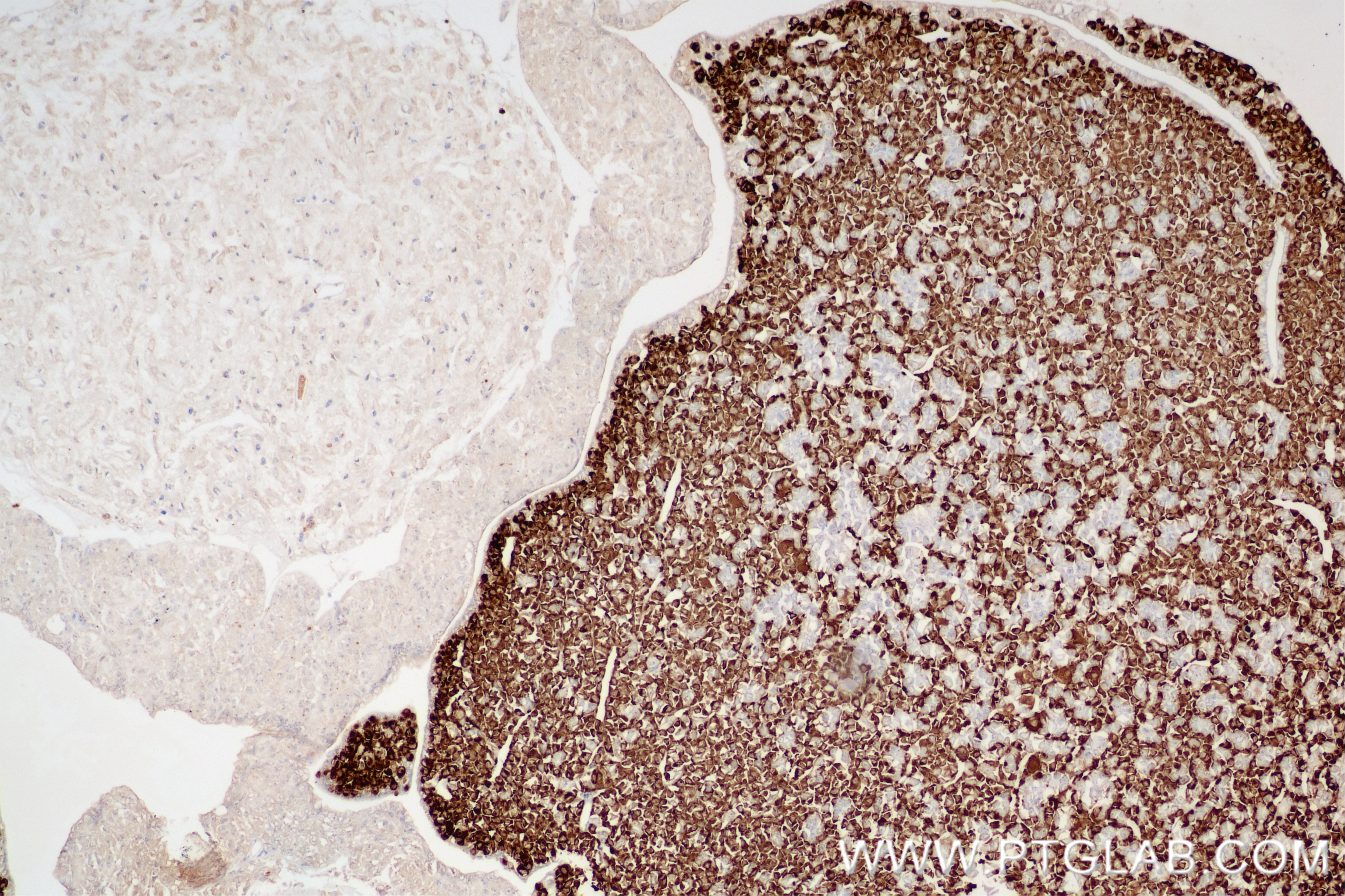 Immunohistochemistry (IHC) staining of mouse pituitary gland tissue using Prolactin Recombinant antibody (85765-3-RR)
