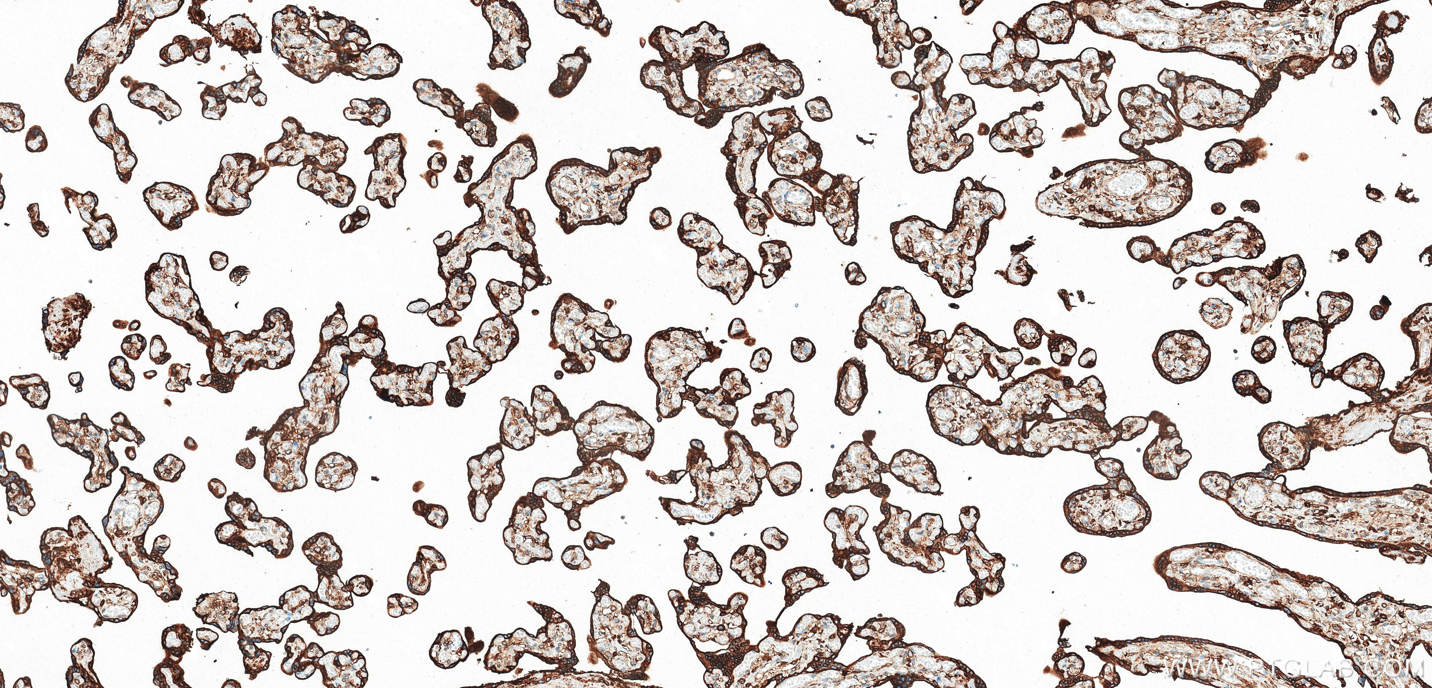 Immunohistochemistry (IHC) staining of human placenta tissue using Prolactin Recombinant monoclonal antibody (85765-3-RR)