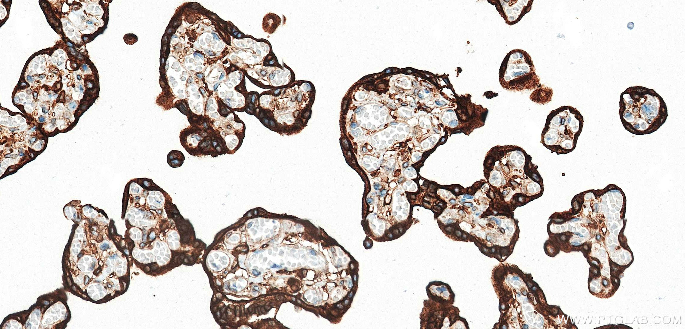Immunohistochemistry (IHC) staining of human placenta tissue using Prolactin Recombinant monoclonal antibody (85765-3-RR)