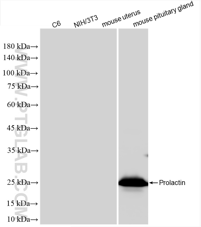 Western Blot (WB) analysis of various lysates using Prolactin Recombinant antibody (85765-3-RR)