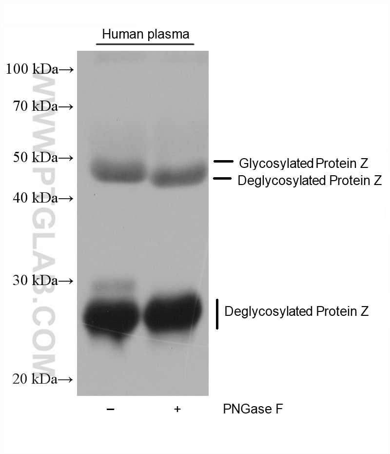 Western Blot (WB) analysis of various lysates using Protein Z Monoclonal antibody (68394-1-Ig)