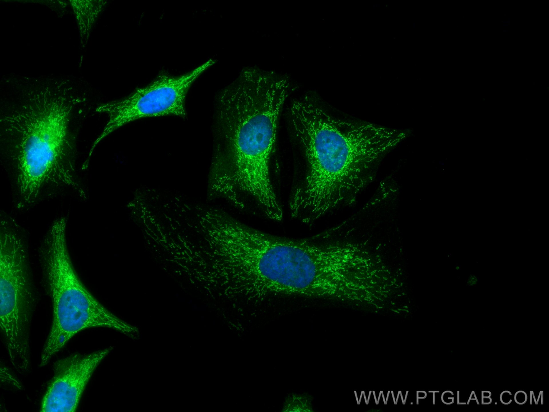 Immunofluorescence (IF) / fluorescent staining of HeLa cells using PRX5 Monoclonal antibody (67599-1-Ig)
