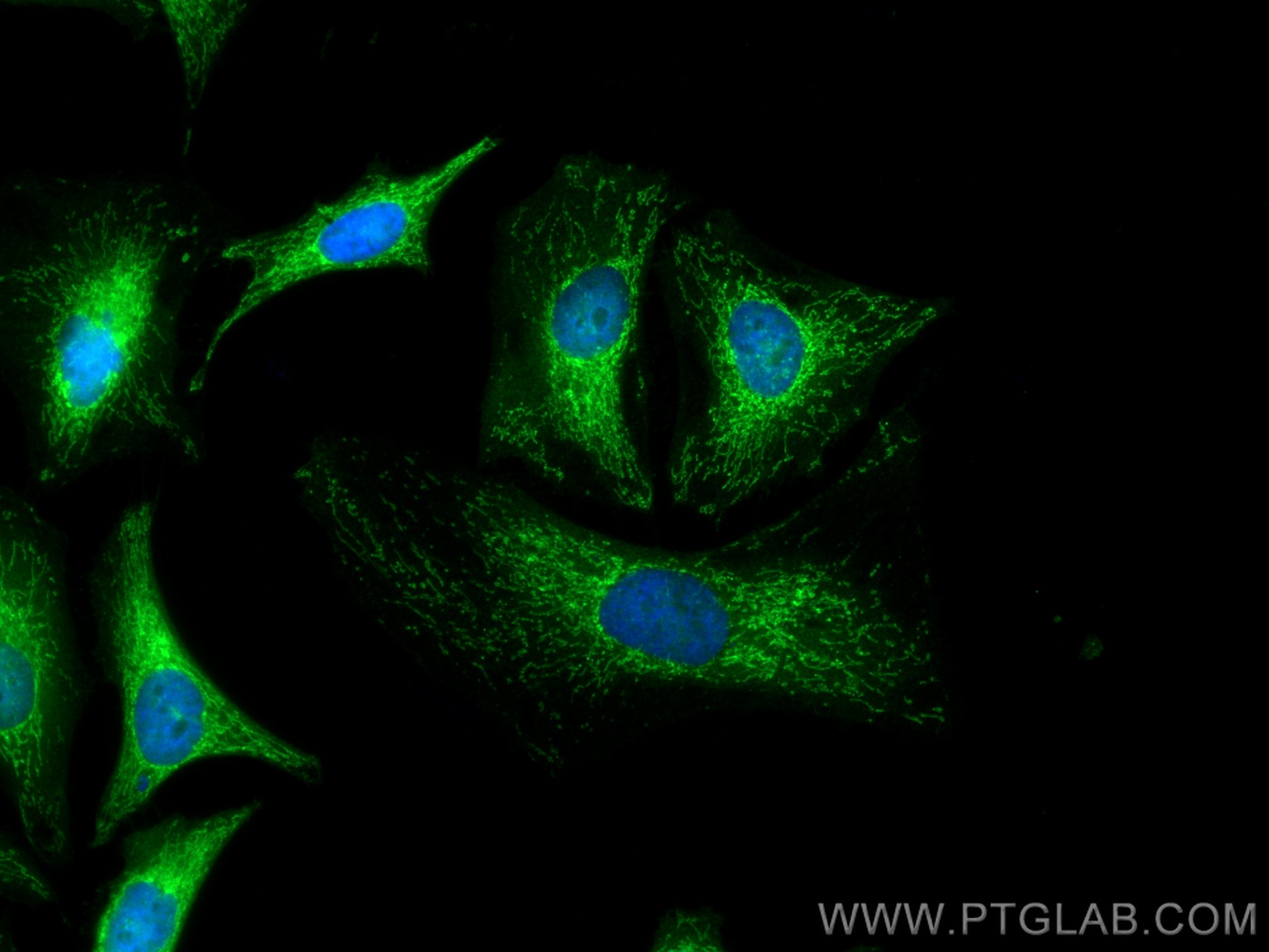 Immunofluorescence (IF) / fluorescent staining of HeLa cells using PRX5 Monoclonal antibody (67599-1-Ig)