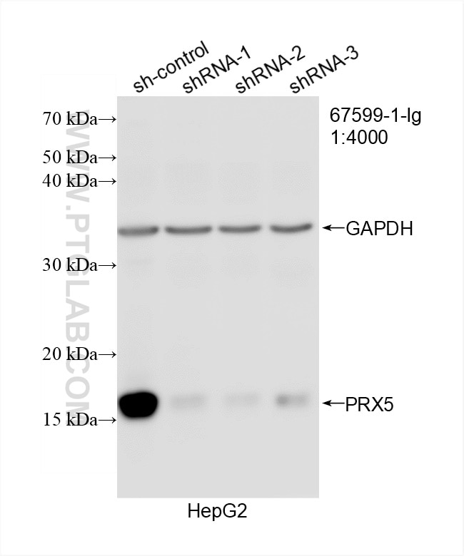 Western Blot (WB) analysis of HepG2 cells using PRX5 Monoclonal antibody (67599-1-Ig)