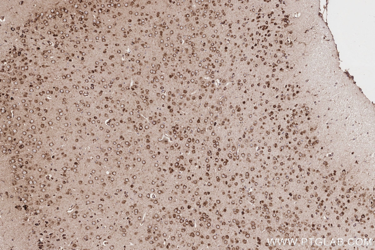Immunohistochemistry (IHC) staining of mouse brain tissue using GlnRS Polyclonal antibody (12645-1-AP)