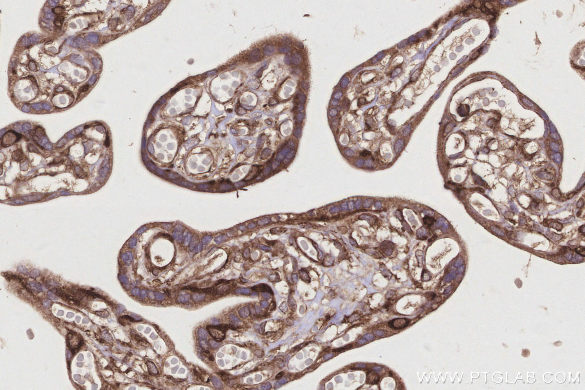 Immunohistochemistry (IHC) staining of human placenta tissue using GlnRS Polyclonal antibody (12645-1-AP)