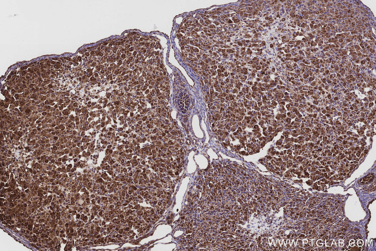 Immunohistochemistry (IHC) staining of rat ovary tissue using GlnRS Polyclonal antibody (12645-1-AP)