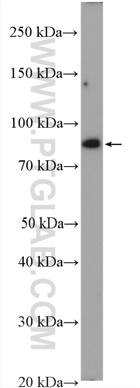Western Blot (WB) analysis of HeLa cells using GlnRS Polyclonal antibody (12645-1-AP)