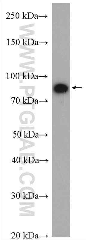 WB analysis of HeLa using 12645-1-AP