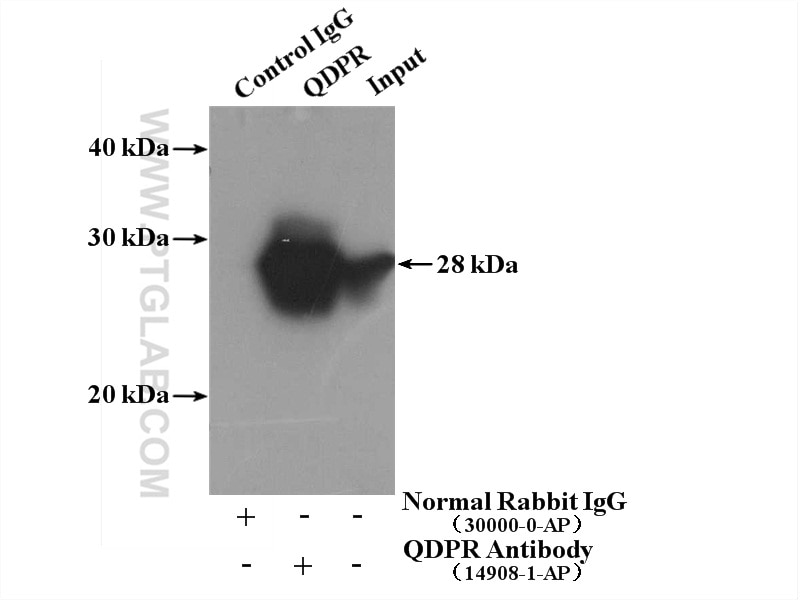 Immunoprecipitation (IP) experiment of mouse liver tissue using QDPR Polyclonal antibody (14908-1-AP)