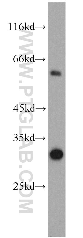 Western Blot (WB) analysis of human liver tissue using QDPR Polyclonal antibody (14908-1-AP)