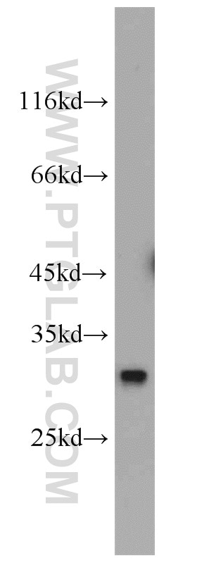 Western Blot (WB) analysis of mouse liver tissue using QDPR Polyclonal antibody (14908-1-AP)