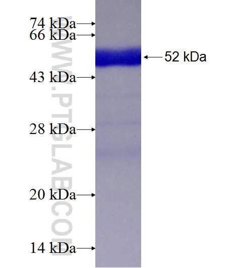 QDPR fusion protein Ag6705 SDS-PAGE