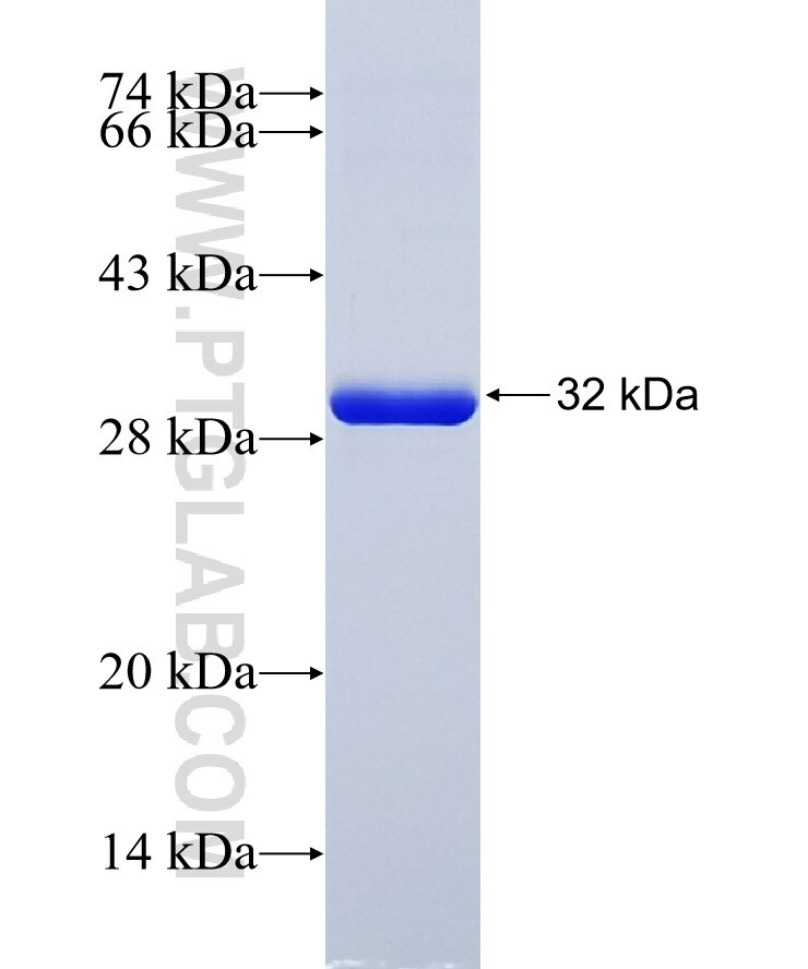 QDPR fusion protein Ag6717 SDS-PAGE
