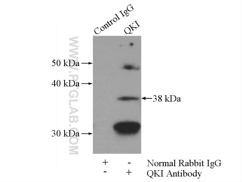 Immunoprecipitation (IP) experiment of K-562 cells using QKI Polyclonal antibody (13169-1-AP)
