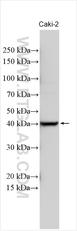 Western Blot (WB) analysis of various lysates using QPCT Polyclonal antibody (18571-1-AP)