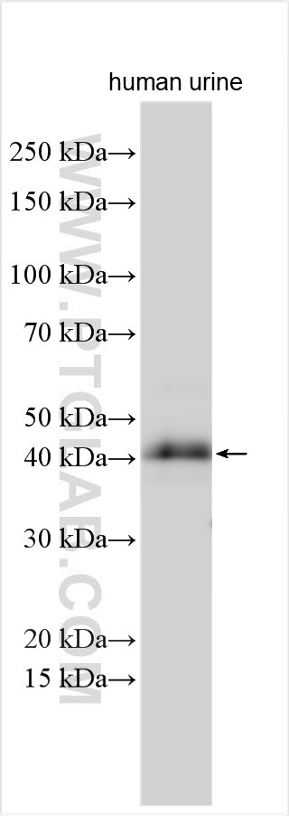 Western Blot (WB) analysis of various lysates using QPCT Polyclonal antibody (18571-1-AP)