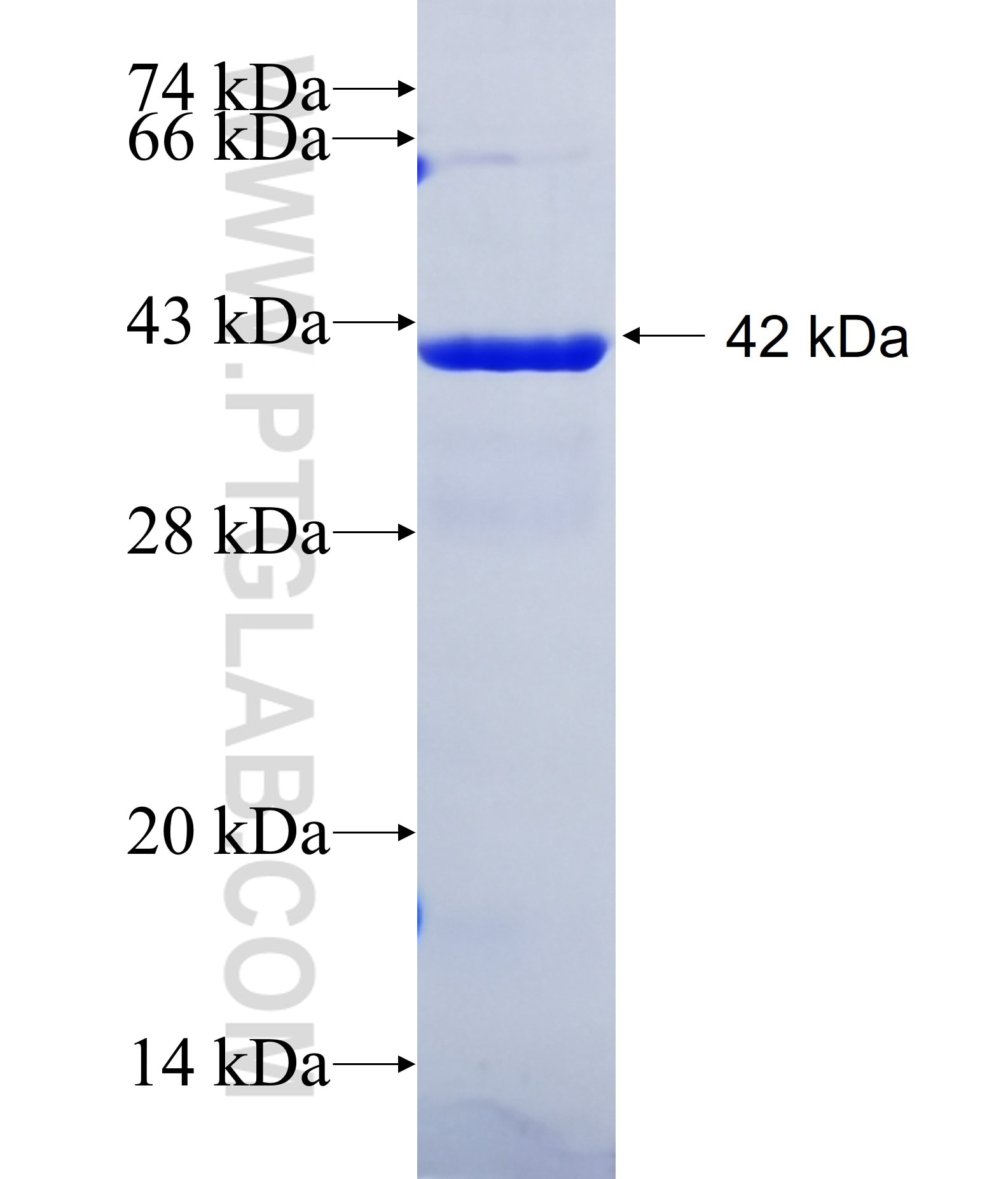 QPCTL fusion protein Ag39921 SDS-PAGE QPCTL fusion protein Ag39921 SDS-PAGE