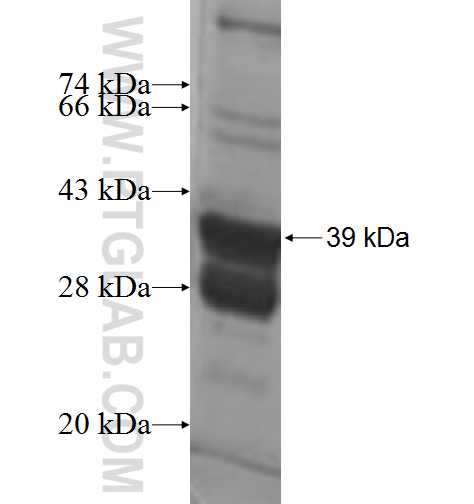 QPCTL fusion protein Ag9533 SDS-PAGE
