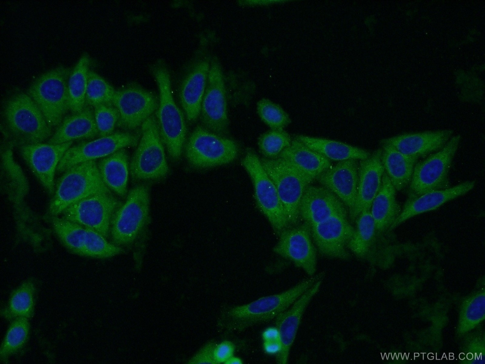 Immunofluorescence (IF) / fluorescent staining of HepG2 cells using QPRT Polyclonal antibody (25174-1-AP)