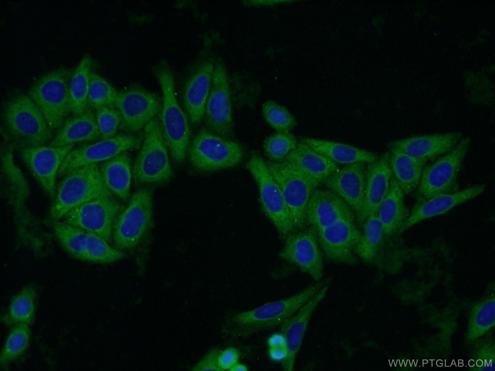 IF Staining of HepG2 using 25174-1-AP