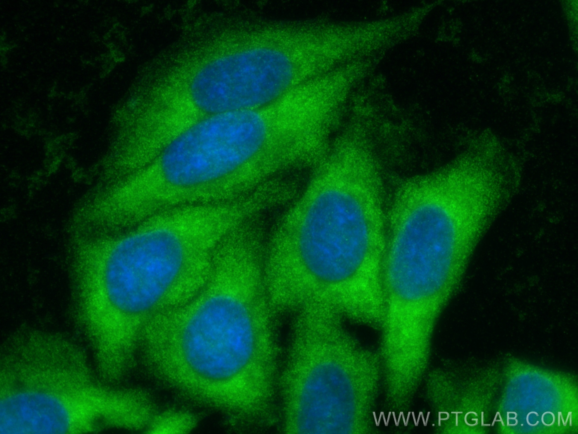 Immunofluorescence (IF) / fluorescent staining of HepG2 cells using QPRT Polyclonal antibody (25174-1-AP)