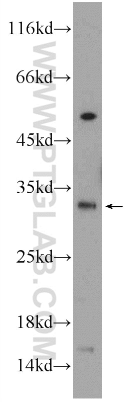 Western Blot (WB) analysis of L02 cells using QPRT Polyclonal antibody (25174-1-AP)