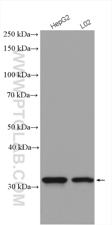 Western Blot (WB) analysis of various lysates using QPRT Polyclonal antibody (25174-1-AP)