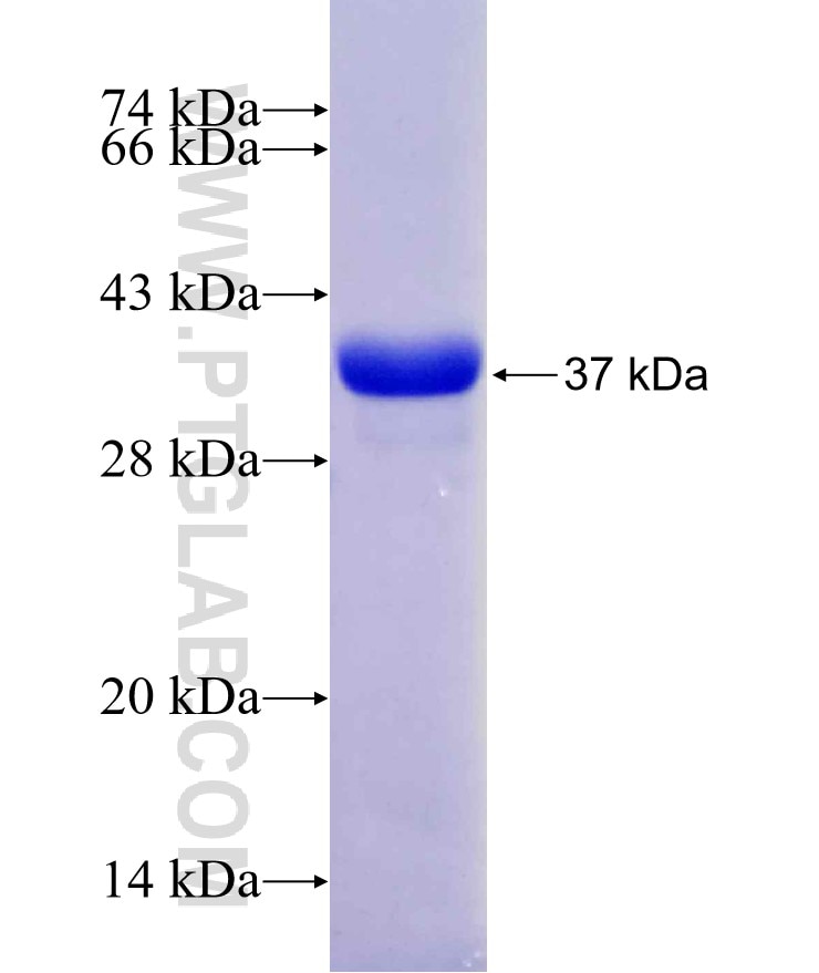 QPRT fusion protein Ag17680 SDS-PAGE