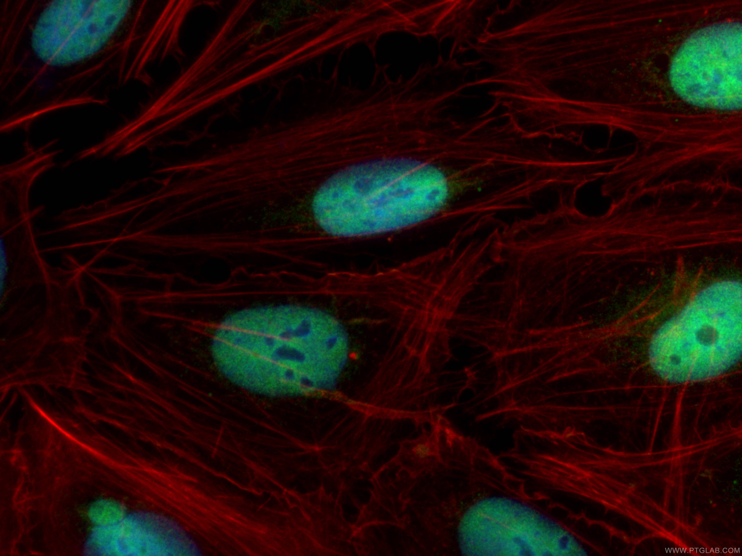 Immunofluorescence (IF) / fluorescent staining of U2OS cells using QRICH1 Polyclonal antibody (30236-1-AP)
