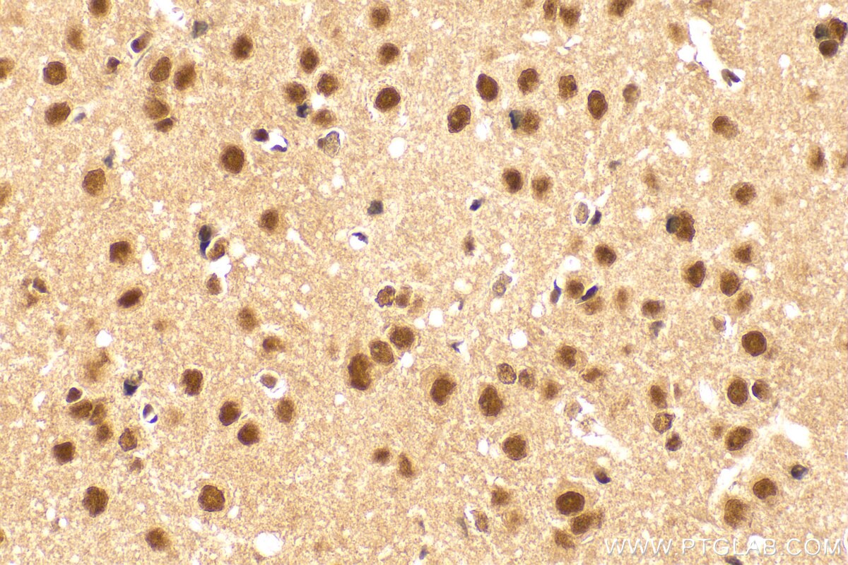 Immunohistochemistry (IHC) staining of rat brain tissue using QRICH1 Polyclonal antibody (30236-1-AP)