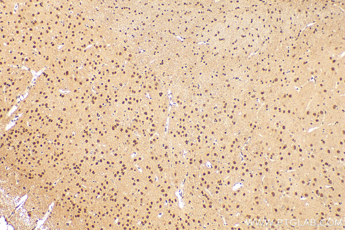 Immunohistochemistry (IHC) staining of rat brain tissue using QRICH1 Polyclonal antibody (30236-1-AP)