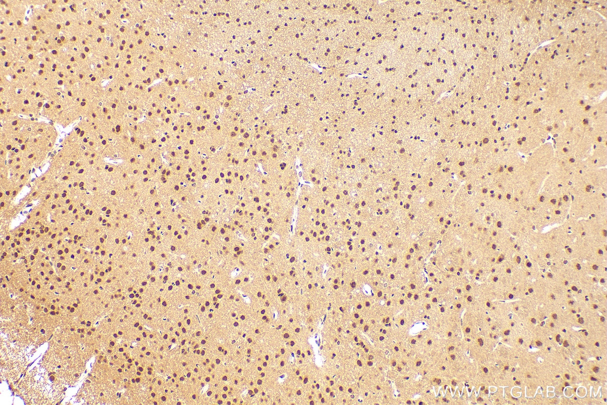 Immunohistochemistry (IHC) staining of rat brain tissue using QRICH1 Polyclonal antibody (30236-1-AP)