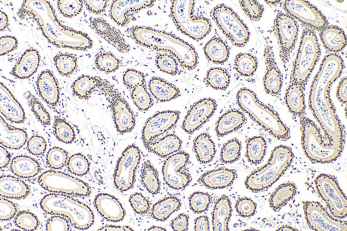 Immunohistochemistry (IHC) staining of mouse testis tissue using QRICH1 Polyclonal antibody (30236-1-AP)